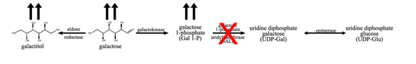 If the activity of the enzyme galactose 1-phosphate uridyltransferase is decreased, there is a buildup of the precursors in the pathway, mainly galactose 1-phosphate and galactose.