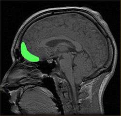 Approximate location of the orbitofrontal cortex.