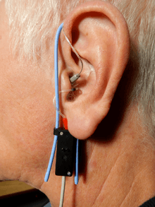 Ear with RIC hearing aid and real ear probe tube in place.